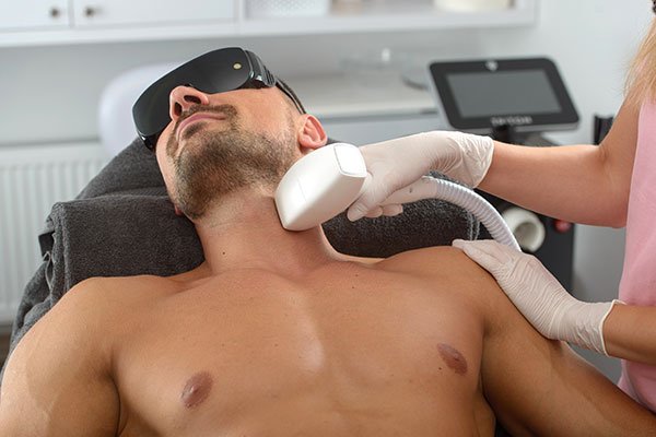 laser hair removal male